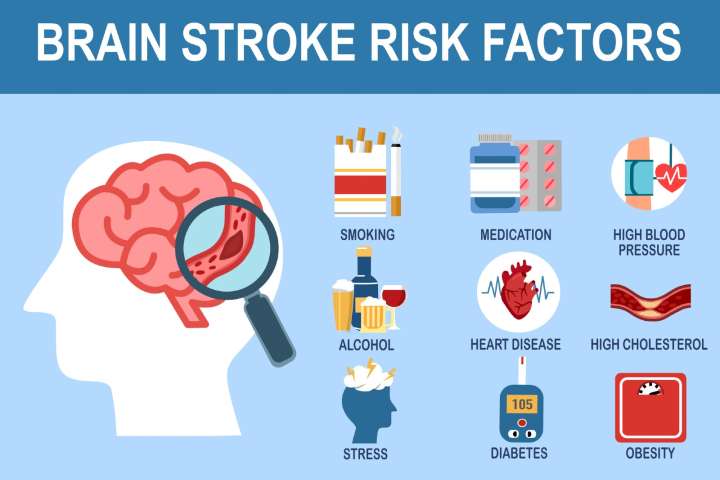 risk of stroke